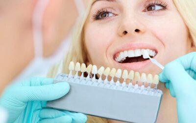 5 Reasons Why Cosmetic Braces in Victoria Are a Better Option for You Than Traditional Braces