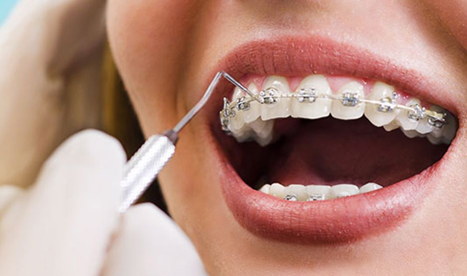 Understanding Orthodontist Treatment: What You Need to Know