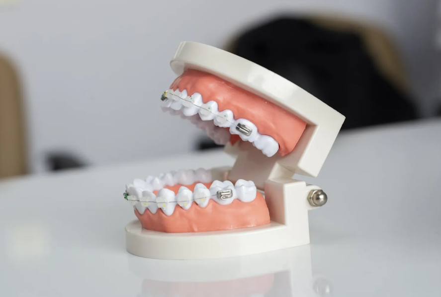 orthodontic treatment